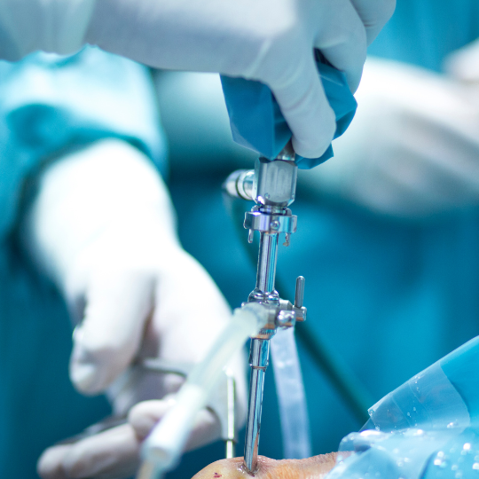 Orthopedic Services - RSP Hospital