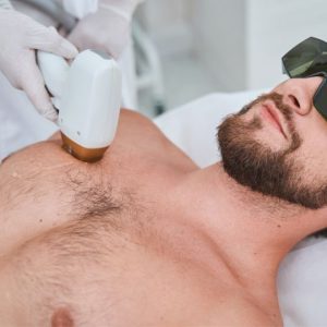 Laser Hair Removal