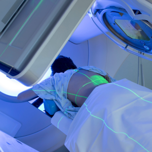 Radiation therapy