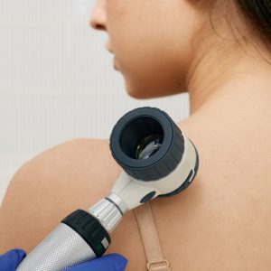Skin Cancer Screening and Treatment